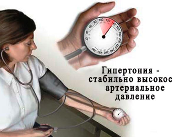 Как сделать себе гипертонию 509 Как сделать себе гипертонию 580